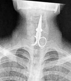 x-ray picture